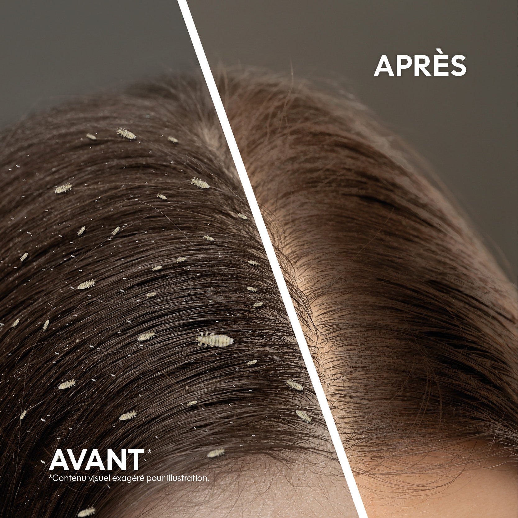 Solution One Shot - Anti poux & lentes